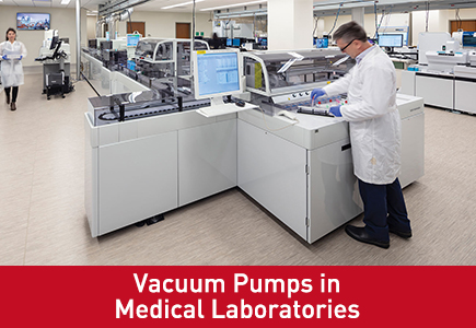 Pompe per vuoto nei laboratori medici: applicazioni e selezione